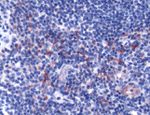 CD178 Antibody in Immunohistochemistry (IHC)