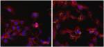 Ferritin Monoclonal Antibody (101)
