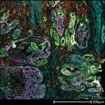Pan Cytokeratin Antibody in Immunohistochemistry (Paraffin) (IHC (P))