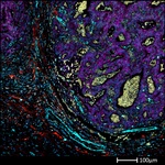Collagen IV Antibody in Immunohistochemistry (Paraffin) (IHC (P))