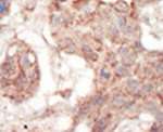 FLT3 Antibody in Immunohistochemistry (IHC)