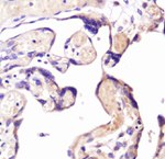 CD266 Antibody in Immunohistochemistry (IHC)