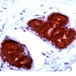 FHIT Antibody in Immunohistochemistry (IHC)