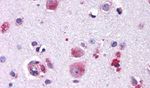 FZD9 Antibody in Immunohistochemistry (Paraffin) (IHC (P))