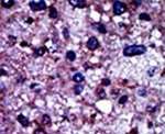 PFKM Antibody in Immunohistochemistry (IHC)
