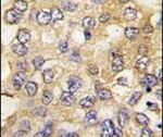 PFKM Antibody in Immunohistochemistry (IHC)