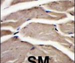 PFKM Antibody in Immunohistochemistry (IHC)