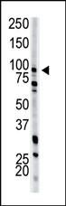 PFKM Antibody in Western Blot (WB)