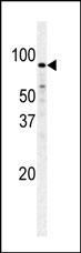 PFKM Antibody in Western Blot (WB)