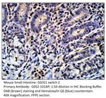 G0/G1 switch 2 Antibody in Immunohistochemistry (IHC)