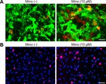 GFP Antibody in Immunohistochemistry (IHC)