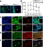 GFP Antibody in Immunohistochemistry (IHC)