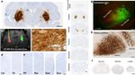 GFP Antibody in Immunohistochemistry (IHC)