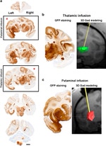 GFP Antibody in Immunohistochemistry (IHC)