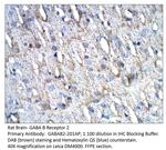 GABA B Receptor 2 Polyclonal Antibody