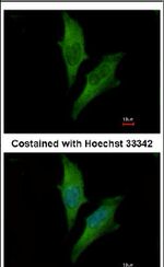 GABARAP Antibody in Immunocytochemistry (ICC/IF)