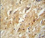 GABBR2 Antibody in Immunohistochemistry (IHC)
