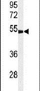 GABRG3 Antibody in Western Blot (WB)
