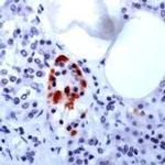 GAD67 Antibody in Immunohistochemistry (IHC)