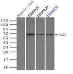 GAD1 Antibody in Immunoprecipitation (IP)