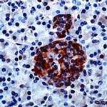GAD65 Antibody in Immunohistochemistry (IHC)