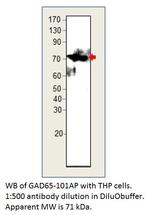 GAD65 Antibody in Western Blot (WB)
