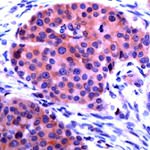 CHOP Antibody in Immunohistochemistry (IHC)