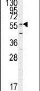GADL1 Antibody in Western Blot (WB)
