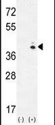 GALK1 Antibody in Western Blot (WB)