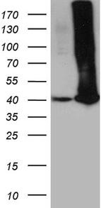 GALM Antibody in Western Blot (WB)