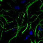 Mouse IgG (H+L) Highly Cross-Adsorbed Secondary Antibody in Immunocytochemistry (ICC/IF)