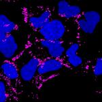 Mouse IgG (H+L) Highly Cross-Adsorbed Secondary Antibody in Immunocytochemistry (ICC/IF)