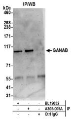 GANAB/Glucosidase II Subunit alpha Antibody in Western Blot (WB)