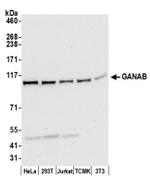GANAB/Glucosidase II Subunit alpha Antibody in Western Blot (WB)