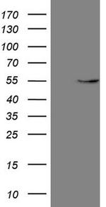 GAS8 Antibody in Western Blot (WB)