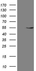 GAS8 Antibody in Western Blot (WB)
