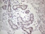 GATA3 Antibody in Immunohistochemistry (Paraffin) (IHC (P))