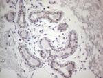 GATA3 Antibody in Immunohistochemistry (Paraffin) (IHC (P))