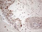 GATA3 Antibody in Immunohistochemistry (Paraffin) (IHC (P))