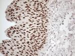 GATA3 Antibody in Immunohistochemistry (Paraffin) (IHC (P))