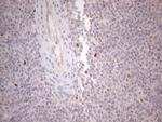GATA3 Antibody in Immunohistochemistry (Paraffin) (IHC (P))