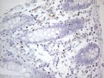 GATA3 Antibody in Immunohistochemistry (Paraffin) (IHC (P))