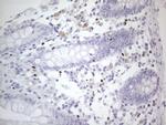 GATA3 Antibody in Immunohistochemistry (Paraffin) (IHC (P))