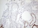 GATA3 Antibody in Immunohistochemistry (Paraffin) (IHC (P))