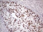 GATA3 Antibody in Immunohistochemistry (Paraffin) (IHC (P))