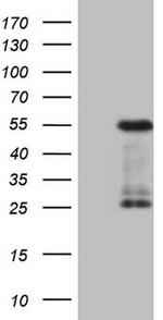 GATA3 Antibody in Western Blot (WB)