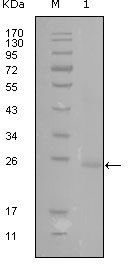 GATA3 Monoclonal Antibody (1A10D1)