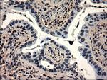 GATA6 Antibody in Immunohistochemistry (Paraffin) (IHC (P))
