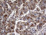 GBA Antibody in Immunohistochemistry (Paraffin) (IHC (P))