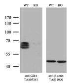 GBA Antibody in Western Blot (WB)